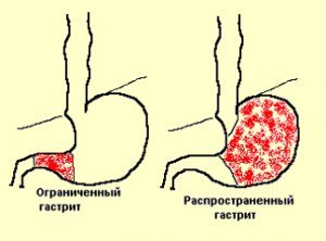 текст при наведении