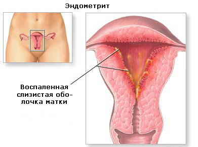 текст при наведении