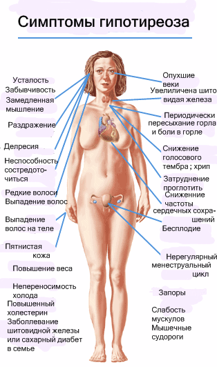 симптомы гипотиреоза